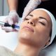 Vos séances de microneedling chez Beaty-wave